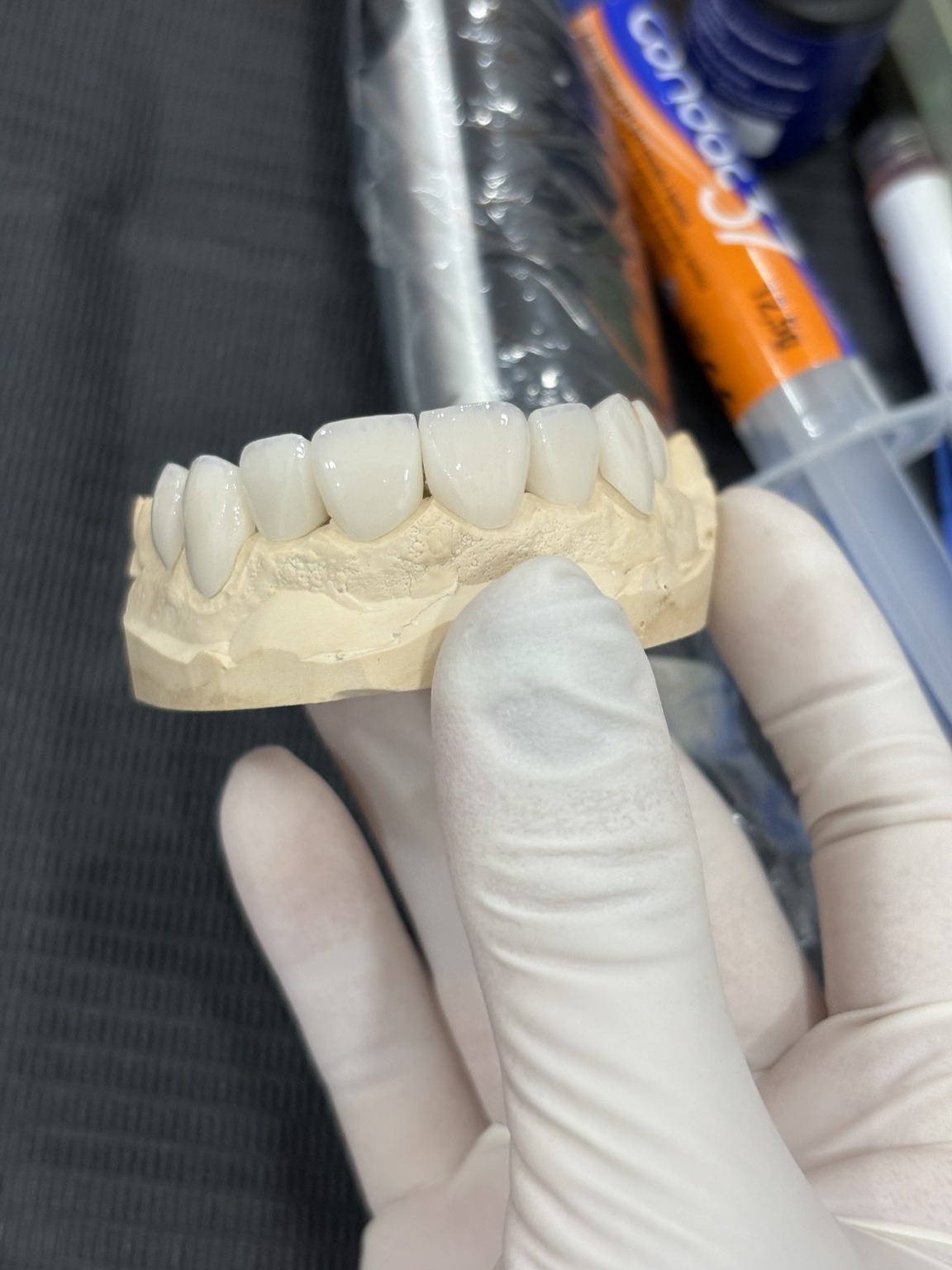 Trabajo cerámico dental en modelo